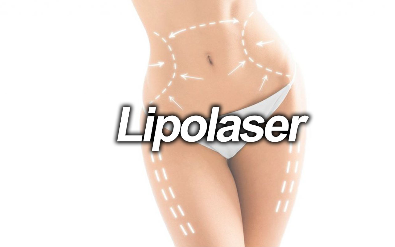Velashape 2
